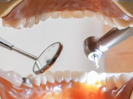 歯科治療を受けるイメージ